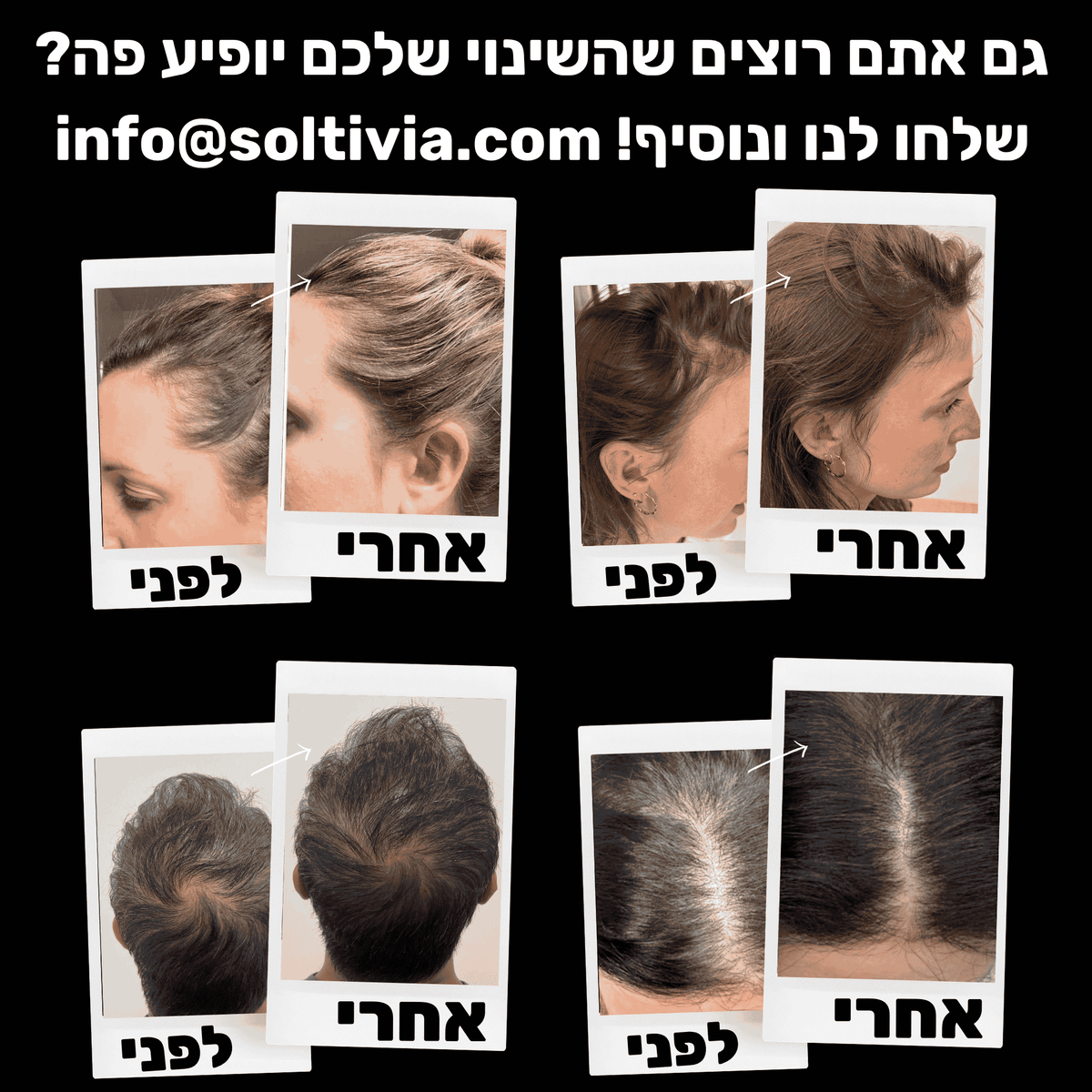 ™RootHaven - שמפו להפחתת נשירה וחיזוק השיער